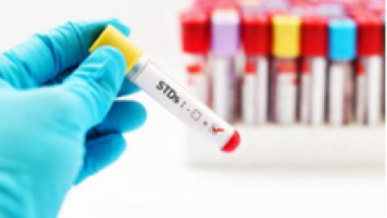 HIV/STI Program